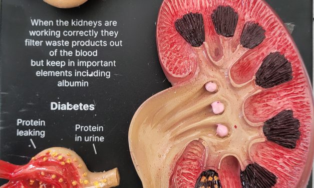 ಶರೀರದ ಪ್ರಧಾನ ಶುದ್ದೀಕರಣ ಘಟಕ ಮೂತ್ರಪಿಂಡ